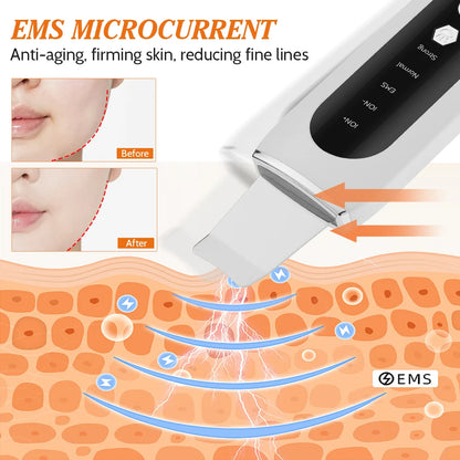 Ultrasonic Skin Scrubber EMS Microcurrent Face Lifting Machine LED Red & Blue Light Blackhead Remover Deep Facial Cleaning Device